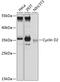 Cyclin D2 antibody, 14-888, ProSci, Western Blot image 