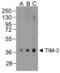 Hepatitis A Virus Cellular Receptor 2 antibody, RF16107, ProSci Inc, Western Blot image 