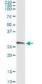 Kallikrein-2 antibody, H00003817-M03, Novus Biologicals, Immunoprecipitation image 