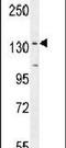 Protein Phosphatase 1 Regulatory Subunit 3A antibody, PA5-24170, Invitrogen Antibodies, Western Blot image 