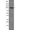 Toll Like Receptor 3 antibody, abx219005, Abbexa, Western Blot image 
