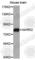 Microtubule Affinity Regulating Kinase 2 antibody, A5919, ABclonal Technology, Western Blot image 