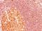 MALT1 Paracaspase antibody, NBP2-29430, Novus Biologicals, Immunohistochemistry paraffin image 