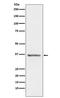 Stanniocalcin 1 antibody, M03402-1, Boster Biological Technology, Western Blot image 