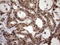 Zinc Finger CCCH-Type Containing 8 antibody, M12985-1, Boster Biological Technology, Immunohistochemistry paraffin image 