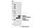 Proteasome 26S Subunit, Non-ATPase 10 antibody, 12985S, Cell Signaling Technology, Western Blot image 