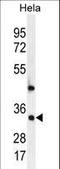 Mediator Complex Subunit 7 antibody, LS-C164126, Lifespan Biosciences, Western Blot image 