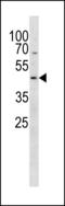 Proteasome 26S Subunit, ATPase 2 antibody, LS-C162237, Lifespan Biosciences, Western Blot image 