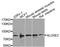 Arachidonate Lipoxygenase 3 antibody, STJ110544, St John