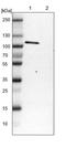 SCY1 Like Pseudokinase 1 antibody, PA5-53267, Invitrogen Antibodies, Western Blot image 