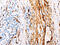 Transglutaminase 2 antibody, CSB-PA546098, Cusabio, Immunohistochemistry paraffin image 