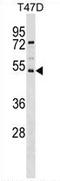 SVOP Like antibody, AP54117PU-N, Origene, Western Blot image 