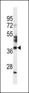 Spermatogenesis-associated protein 4 antibody, LS-C157072, Lifespan Biosciences, Western Blot image 