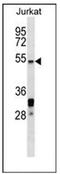 Heat Shock Transcription Factor 5 antibody, AP52117PU-N, Origene, Western Blot image 