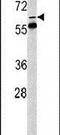 FKBP Prolyl Isomerase 10 antibody, PA5-14272, Invitrogen Antibodies, Western Blot image 