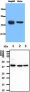 Acetyl-CoA Acetyltransferase 1 antibody, MBS200223, MyBioSource, Western Blot image 