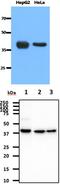 MAT antibody, MBS200223, MyBioSource, Western Blot image 