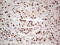 RB Transcriptional Corepressor 1 antibody, LS-C790685, Lifespan Biosciences, Immunohistochemistry paraffin image 