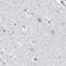 Ubiquitin Interaction Motif Containing 1 antibody, PA5-57979, Invitrogen Antibodies, Immunohistochemistry paraffin image 