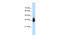 Homeobox C9 antibody, 28-960, ProSci, Western Blot image 