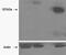 Tankyrase 2 antibody, PA5-17930, Invitrogen Antibodies, Western Blot image 