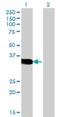 Cone-rod homeobox protein antibody, H00001406-M06, Novus Biologicals, Western Blot image 