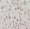 EPH Receptor A2 antibody, FNab09858, FineTest, Immunohistochemistry paraffin image 