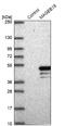 MAGE Family Member B18 antibody, NBP2-14211, Novus Biologicals, Western Blot image 