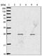 Signal Regulatory Protein Beta 2 antibody, PA5-61637, Invitrogen Antibodies, Western Blot image 