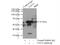 UDP-Glucose Ceramide Glucosyltransferase antibody, 12869-1-AP, Proteintech Group, Immunoprecipitation image 