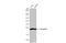 Transgelin antibody, GTX636672, GeneTex, Western Blot image 