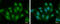 Trafficking Kinesin Protein 2 antibody, GTX121628, GeneTex, Immunofluorescence image 