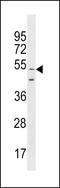 Golgin A6 Family Like 9 antibody, LS-C159754, Lifespan Biosciences, Western Blot image 