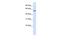 5'-Aminolevulinate Synthase 2 antibody, PA5-42078, Invitrogen Antibodies, Western Blot image 