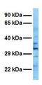 RALY Heterogeneous Nuclear Ribonucleoprotein antibody, GTX47714, GeneTex, Western Blot image 