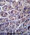 Calpain 8 antibody, abx027249, Abbexa, Immunohistochemistry paraffin image 