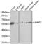 Serine hydroxymethyltransferase, mitochondrial antibody, A1215, ABclonal Technology, Western Blot image 