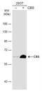 Cystathionine-Beta-Synthase antibody, NBP2-43604, Novus Biologicals, Western Blot image 