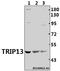 Thyroid Hormone Receptor Interactor 13 antibody, A06921, Boster Biological Technology, Western Blot image 