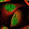 Cyclin Dependent Kinase 9 antibody, NBP1-86808, Novus Biologicals, Immunofluorescence image 