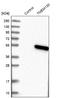 Transmembrane Protein 130 antibody, NBP1-84099, Novus Biologicals, Western Blot image 