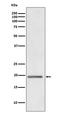 WAP Four-Disulfide Core Domain 2 antibody, M02685, Boster Biological Technology, Western Blot image 