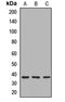 Charged multivesicular body protein 2a antibody, LS-C668155, Lifespan Biosciences, Western Blot image 