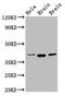 ERGIC And Golgi 2 antibody, CSB-PA857020EA01HU, Cusabio, Western Blot image 