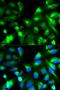 Synaptosome Associated Protein 25 antibody, LS-C331188, Lifespan Biosciences, Immunofluorescence image 