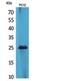 CKLF Like MARVEL Transmembrane Domain Containing 5 antibody, STJ96850, St John