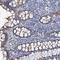 Core-Binding Factor Subunit Beta antibody, NBP1-87300, Novus Biologicals, Immunohistochemistry paraffin image 