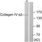 Collagen Type IV Alpha 2 Chain antibody, PA5-38875, Invitrogen Antibodies, Western Blot image 