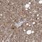 Tankyrase 2 antibody, NBP1-80947, Novus Biologicals, Immunohistochemistry paraffin image 