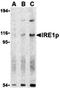 Endoplasmic Reticulum To Nucleus Signaling 1 antibody, orb74676, Biorbyt, Western Blot image 